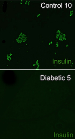 Diabetic dogs had a sharp loss of insulin-producing beta cells compared to non-diabetic dogs.