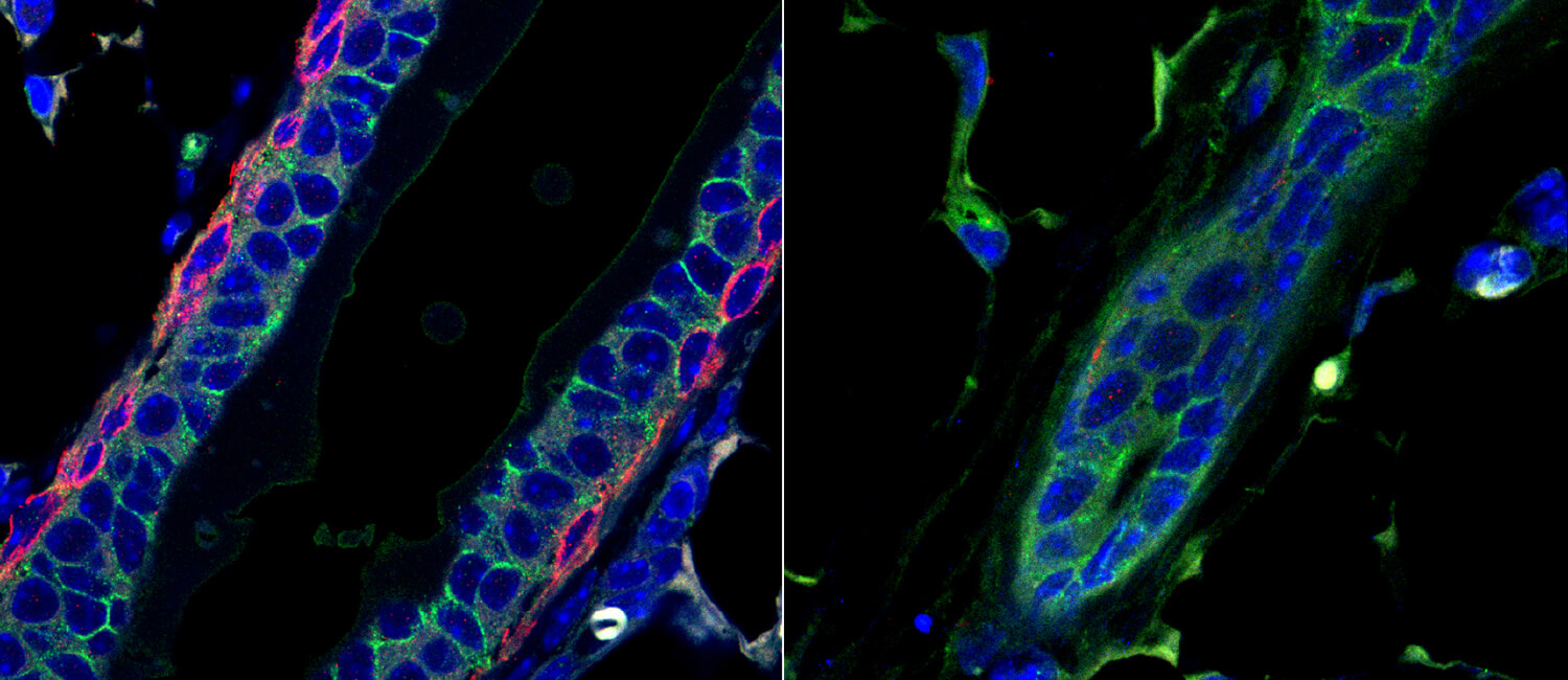 Led by Penn Vet scientists, a new study reveals that the protein deltaNp63, which fosters the initiation and progression of triple-negative breast cancer, also helps fuel mammary gland development during puberty in mice. Without it (right panel), the mammary duct had altered structure.