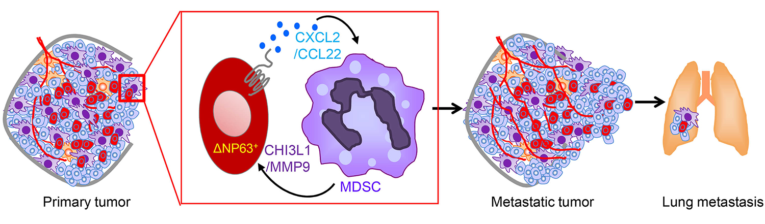 Immune cells called myeloid-derived immunosuppressor cells (MDSCs) play a key role in the progression and aggressiveness of triple-negative breast cancers. Blocking them could offer a therapeutic target in the disease, which notoriously resists many standard treatments.  