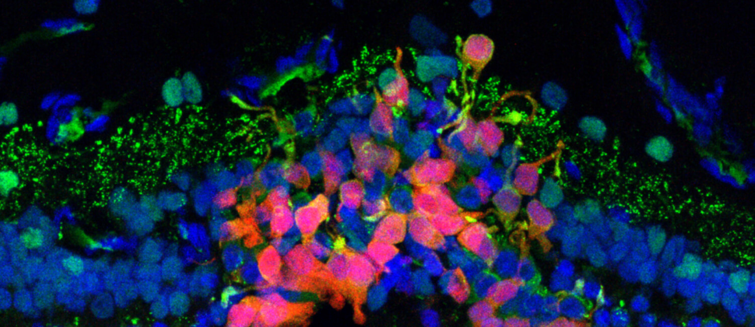 Following a transplantation procedure, human photoreceptor precursor cells labeled red migrated and integrated into a degenerated canine retina. The green label is a synaptic maker, suggesting the transplanted cells began forming a connection with second-order neurons in the retina. (Image: Courtesy of the Beltran laboratory/Stem Cell Reports)