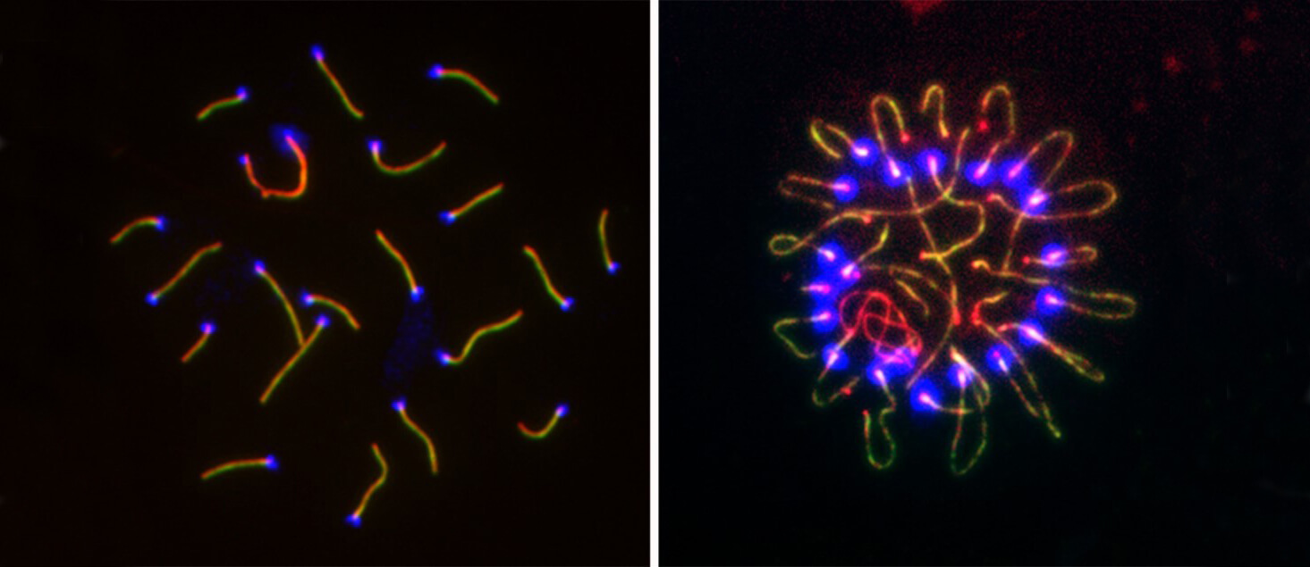 In a recent study by P. Jeremy Wang, inactivating the gene YTHDC2, which is required for meiosis to progress through all of its proper stages, led to an odd clustering of chromosome ends (at right).