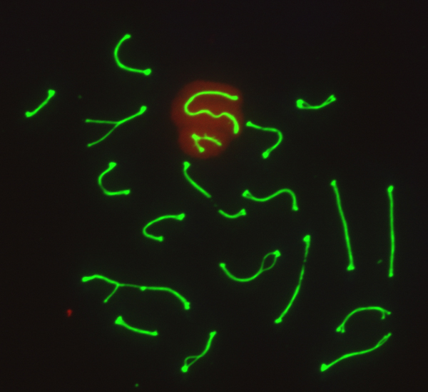 Pachytene spermatocyte with synapsed chromosomes	