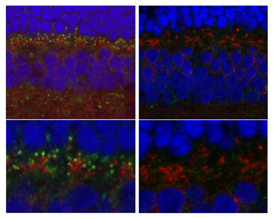 Research led by Penn Vet scientists has revealed the gene underlying a form of night blindness that affects dogs. Dogs with the mutation in the LRIT3  gene (right panels) have less of the resulting protein (labeled yellow-green) in the tips of the retina's ON-bipolar cells than unaffected dogs (left panels).