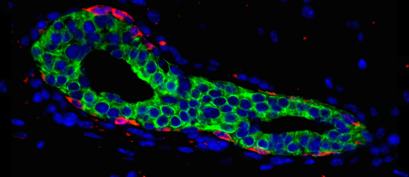 A Penn-led team identified Dll1, a signaling molecule as a marker of mammary gland stem cells, and one that plays a vital role in normal development of the mammary tissue. Above, a cross-section of a mouse mammary gland. (Image: Sushil Kumar and Rumela Chakrabarti) 
