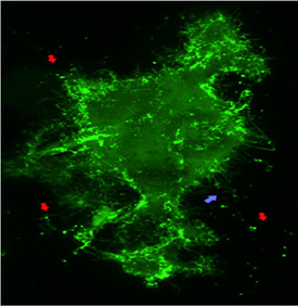 A confocal image of a live mammalian cell expressing a GFP-Ebola VP40 fusion protein (green). Strong fluorescence at the periphery, or cell surface, and the filamentous projections are indicative of budding virus-like particles from the cell surface.   Image taken at the PennVet Imaging Core (PVIC), directed by Bruce Freedman and managed by Gordon Ruthel