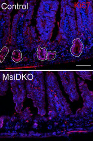 After radiation, normal mice began to regrow their intestinal epithelial tissue (top), but those lacking MSI (bottom) couldn't.