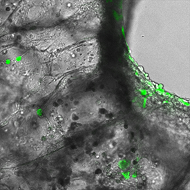 RSV, labeled green, infects a sample of lung tissue. Defective versions of the viral genome trigger their own demise.