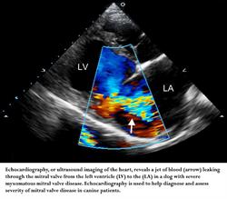 Echocardiography, or ultrasound imaging of the heart, reveals a jet of blood (arrow) leaking through the mitral valve from the left ventricle (LV) to the (LA) in a dog with severe myxomatous mitral valve disease. Echocardiography is used to help diagnose and assess severity of mitral valve disease in canine patients. 