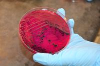 A Salmonella culture grows inside this petri dish.
