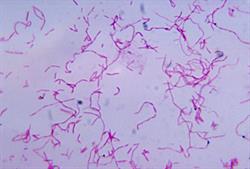 This bacterium is a normal inhabitant of the mouth and plays a role in periodontal disease.