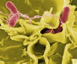 Salmonella bacteria shown in red