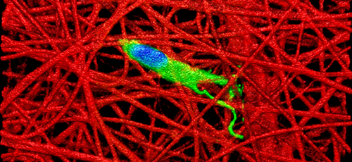 A meniscus cell (meniscal fibrochondrocyte) migrates onto an electrospun polymer nanofibrous scaffold. The red represents individual polycaprolactone nanofibers.