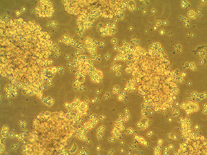This photo shows Listeria bacteria cells genetically modified by the Mason laboratory to express the tumor protein HER2/neu, as well as reduce its virulence.
