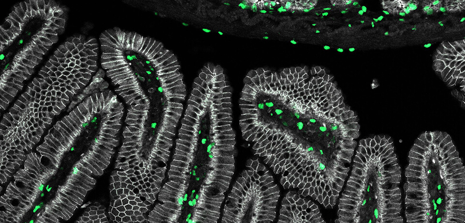 Intestinal cells are loaded with a green fluorescent protein (GFP) fused to a histone protein (H2B-GFP).
