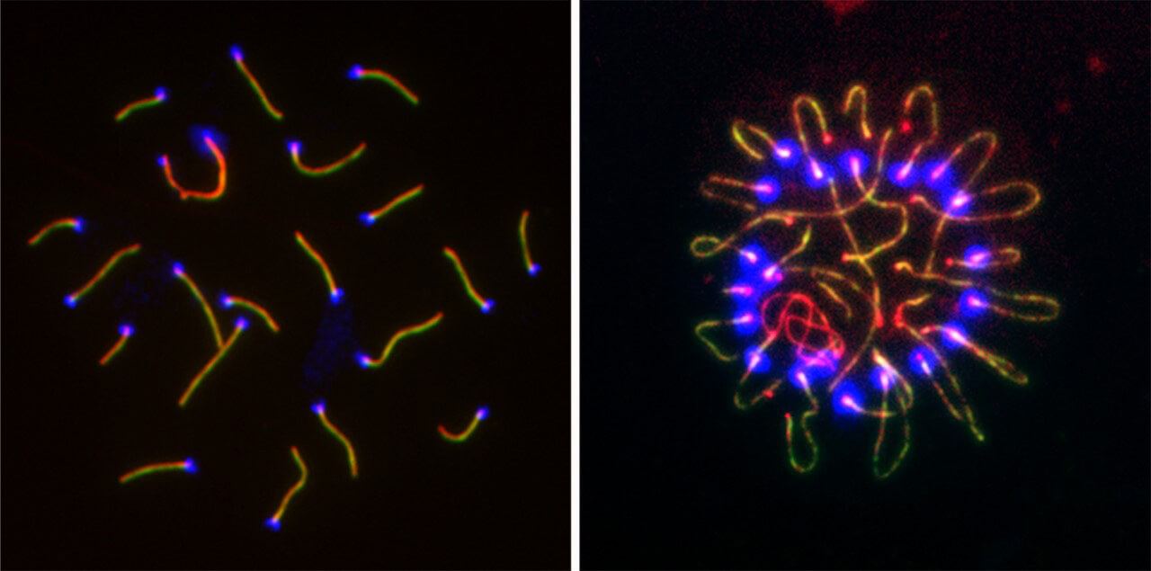 In a recent study out of the Wang lab, inactivating the gene YTHDC2, which is required for meiosis to progress through all of its proper stages, led to an odd clustering of chromosome ends (at right).