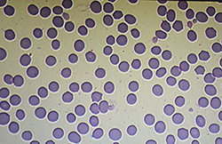 Blood cells after storage