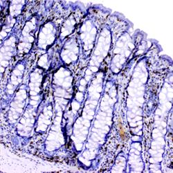 Immunohistochemistry (special stains of tissues) can highlight specific inflammatory cells. Mucosa of the normal horse.