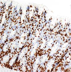 Immunohistochemistry (special stains of tissues) can highlight specific inflammatory cells. Increased numbers of CD3-positive T lymphocytes infiltrate (brown cells) the mucosa of the horse with recurrent colic.