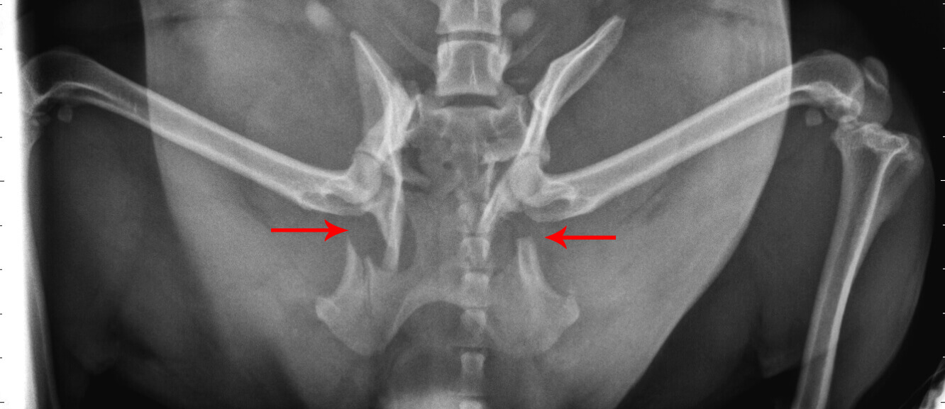 In this x-ray, the red arrows point to just two of Angel's fractures.