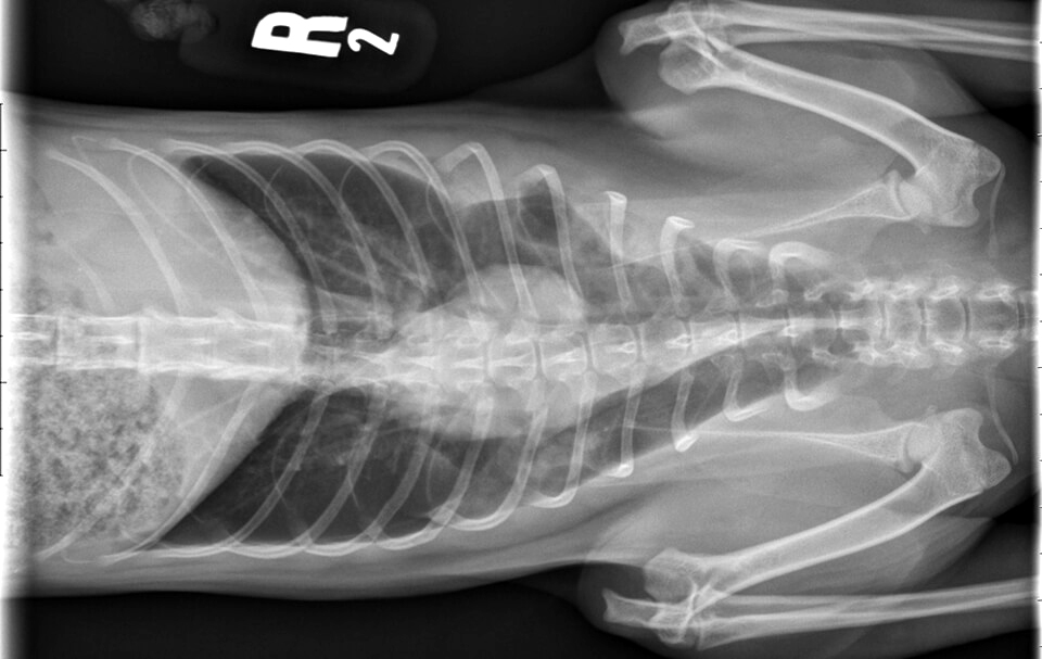 X-ray of Bridget's chest shows the broken ribs suffered in her fall.