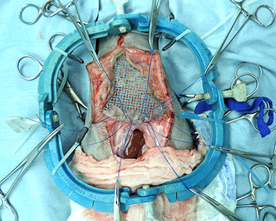 Titanium mesh was implanted into Athena's chest to protect her heart.