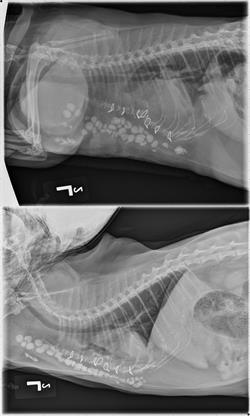 The top x-ray shows that the antibiotic beads had moved from the incision site. The bottom x-ray shows the beads in their proper place. 