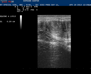 embryo ultrasound, Foal Cam, New Bolton Center