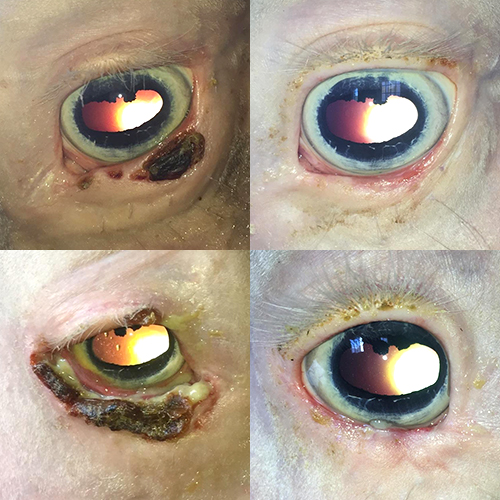 Top row: Anita's left eye two weeks after surgery and laser treatment (left), and two months after (right). Bottom row: Anita's right eye two weeks after surgery and laser treatment (left), and two months after (right). 