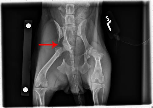 The arrow shows the fracture of Lucy's ilium