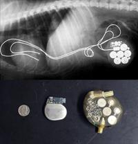 Top, an x-ray showing the original pacemaker placed in 1967. Bottom, size comparison between the original pacemaker (r) and the modern version that Jake recieved (l).