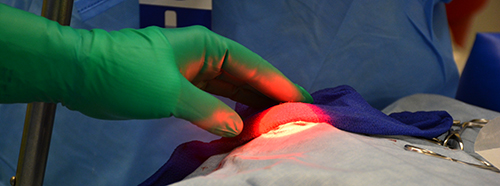 The laser's beam of light covers Anita's eye during the laser treatment.