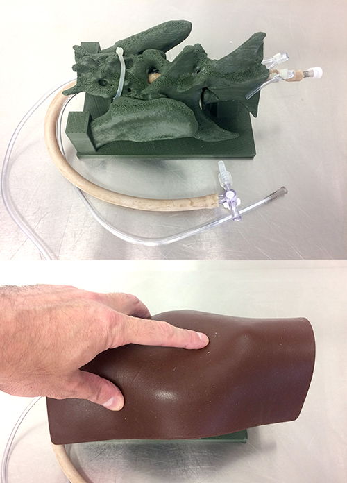The 3D-printed model Kaiman developed to teach epidural injections