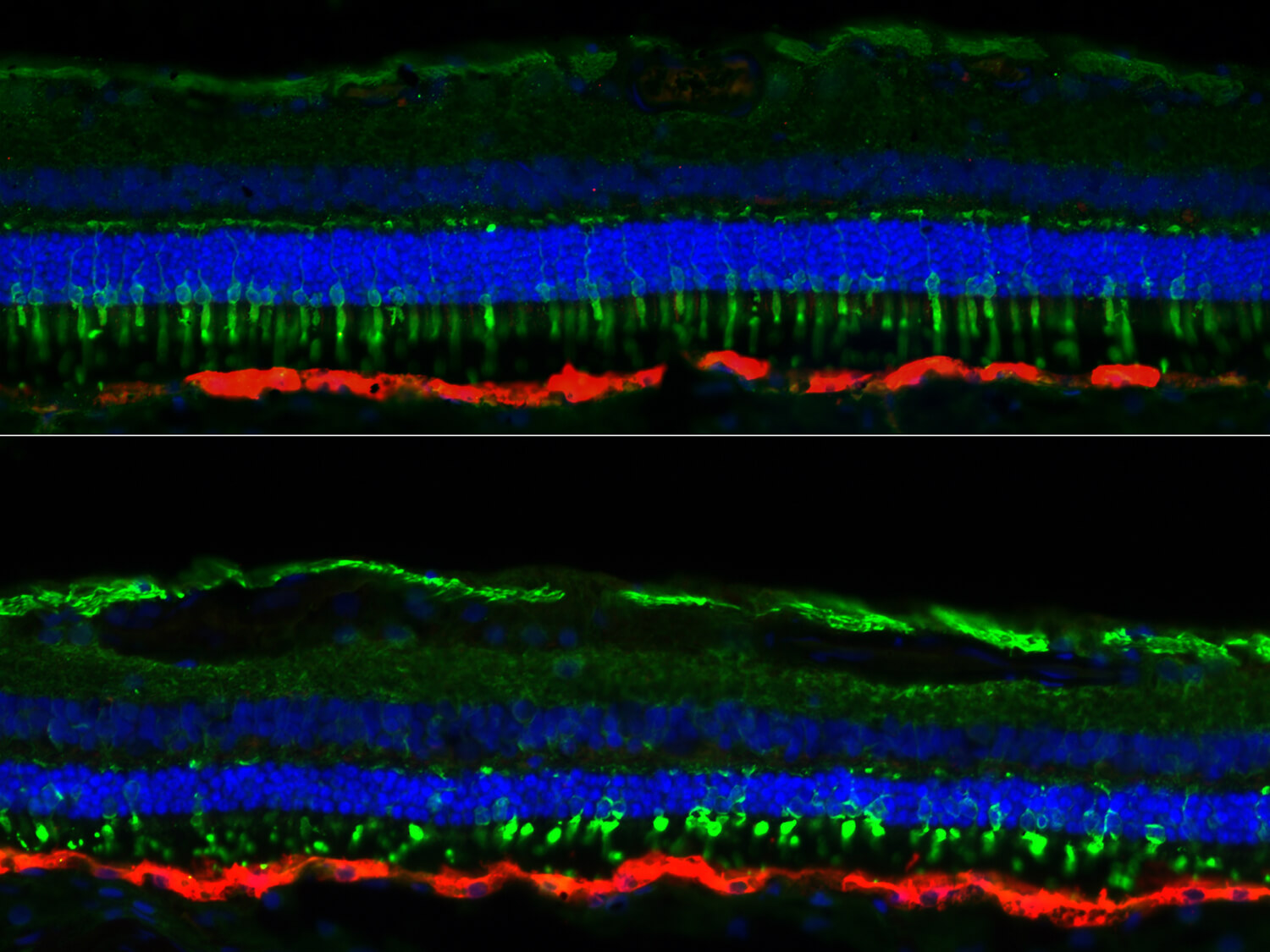 Using a canine model of the vision disorder Leber congenital amaurosis, Penn researchers found that photoreceptor cells continue to deteriorate after treatment if it is given too late.
