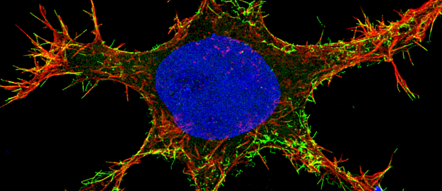 In an experiment by the School of Veterinary Medicine’s Ronald Harty and Bruce Freedman, virus-like particles of Ebola (in green and yellow), which mimic the process by which the authentic Ebola virus spreads, exit a cell along filaments of actin (in red), a structural protein. Harty and Freedman are designing compounds to block this process, increasing the likelihood an infected individual could recover. (Photo: Gordon Ruthel)