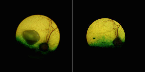 A view of a dog's eye before (left) and 5 years after (right) the gene therapy underscores how the treatment reversed a sizeable lesion--and lasted. The black mark visible on the treated eye is the injection site.