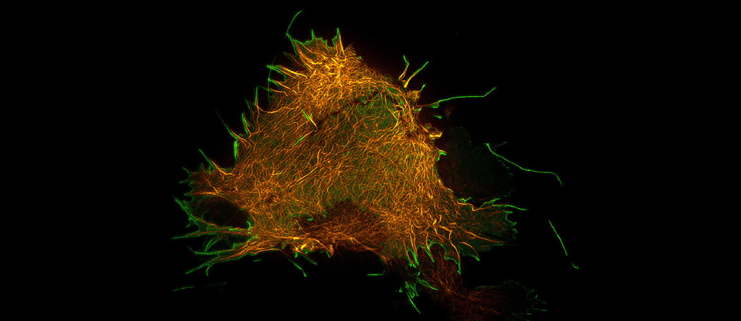 Marburg virus-like particles (in green, which are not infectious) “bud,” or exit from the surface of a host cell, with help from a host protein (in yellow). Research by Penn Vet researchers and colleagues have identified a compound that can reduce the ability of the Marburg virus to spread in an animal model by blocking the host-viral interaction.