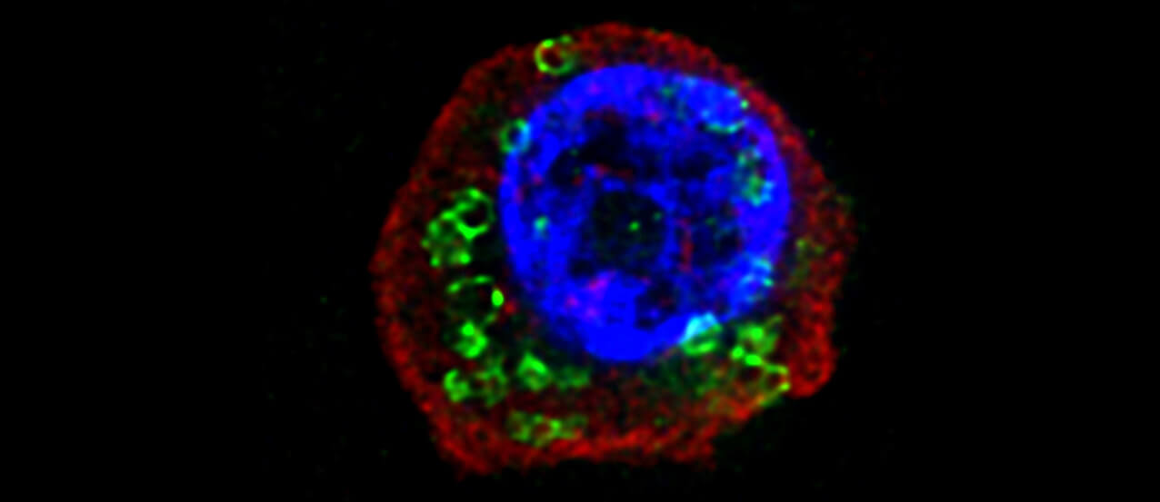 Samples of nasal polyps removed from patients with chronic rhinosinusitis revealed the perforin-2 protein (labeled in green) in the cellular plasma membrane. A pore protein, perforin-2 may be how IL-33, a key immune signaling molecule, is able to exit these cells to trigger an immune response, according to new work led by a Penn Vet-led team.