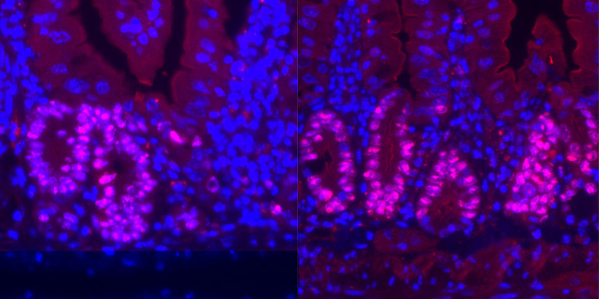 Intestines CRWhen mice were allowed to eat without limit and were then exposed to radiation, their intestinal cells' (in red) regeneration was limited (left). Mice fed a calorie-restricted diet showed a greatly enhanced regenerative capacity in their intestinal tissue (right). 
