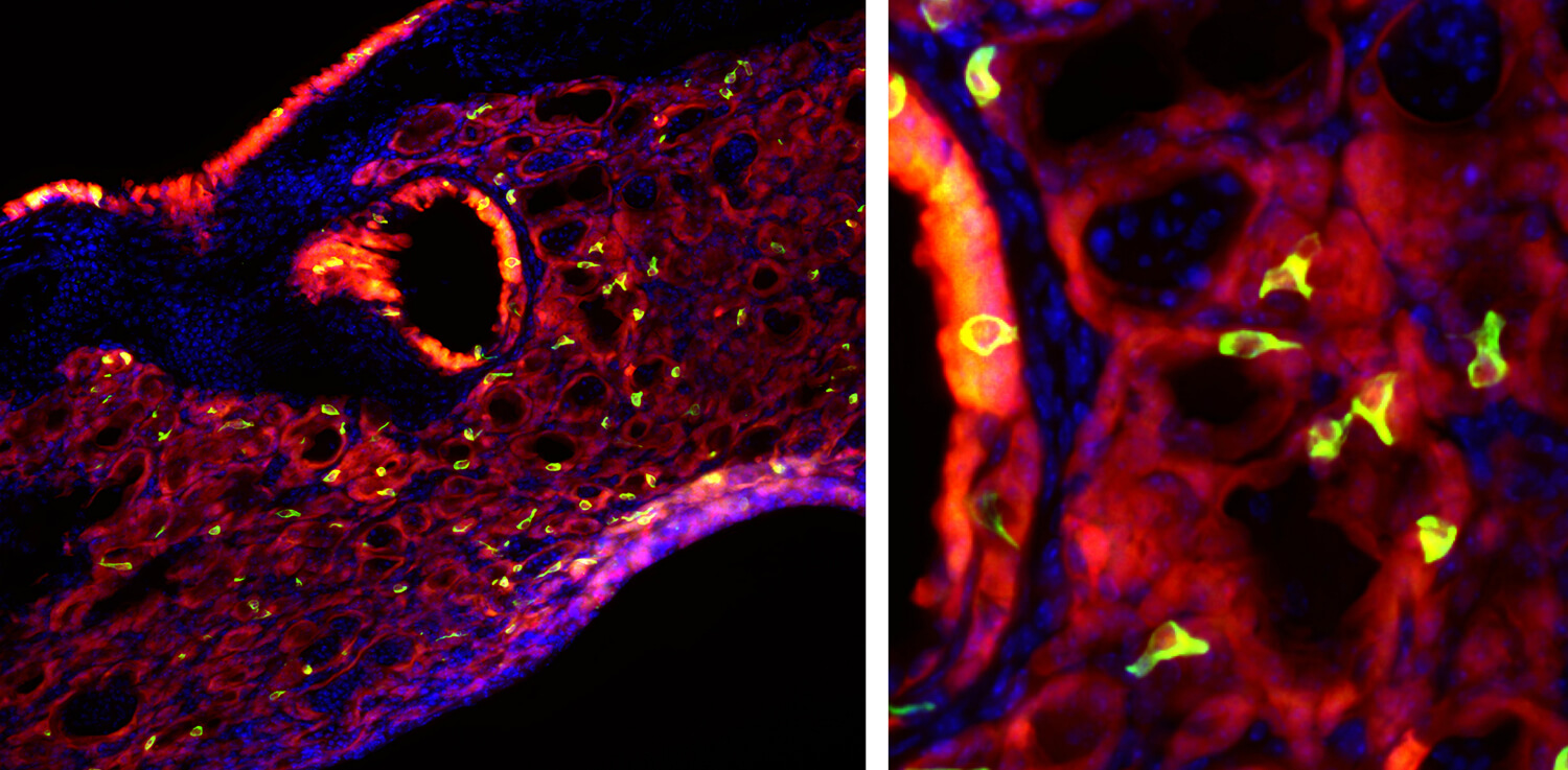 The discovery of tuft cells (in green) in mice lungs after flu gives researchers insights into how a bad respiratory infection may set the stage for certain inflammatory conditions, such as asthma. The cells are named for the elongated microvilli which project from their surface.