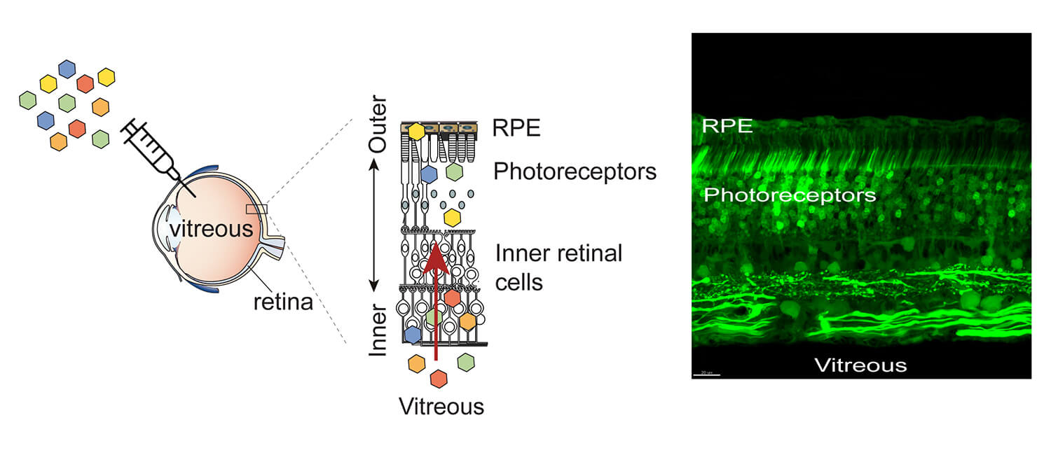 A newly developed method uses single-cell analysis to screen suitable viral vectors for gene therapy. The process led to candidates vectors that can precisely target cells of the outer retina to treat inherited vision disorders.