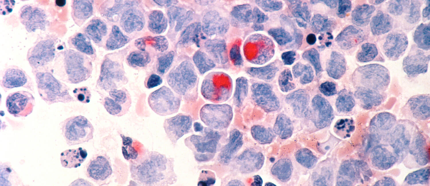 New findings from a study led by the School of Veterinary Medicine’s Andrés Blanco point a way forward for the treatment of acute myeloid leukemia. (Image: National Cancer Institute)