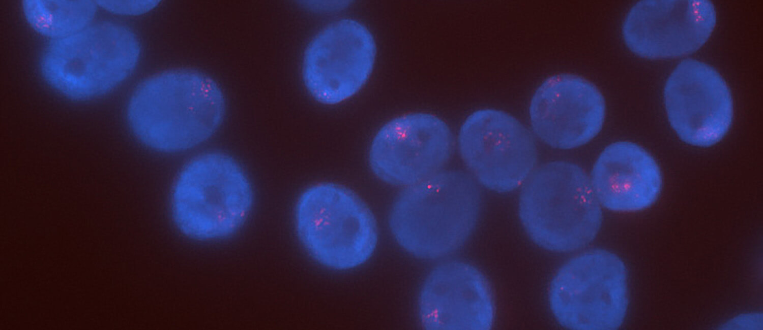 microscopic image of lung cells