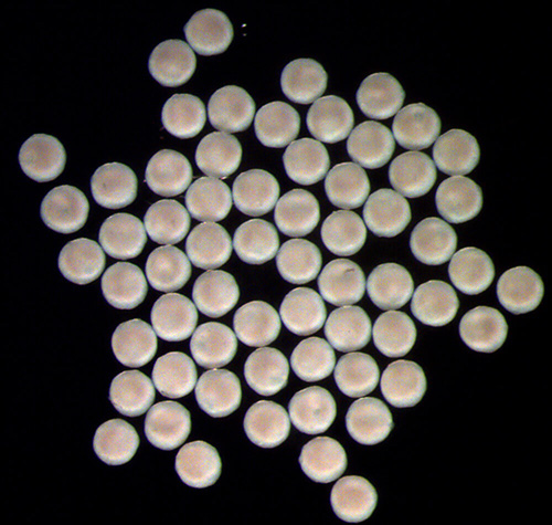 Photo of adrenal organoids grown in the Sasaki lab
