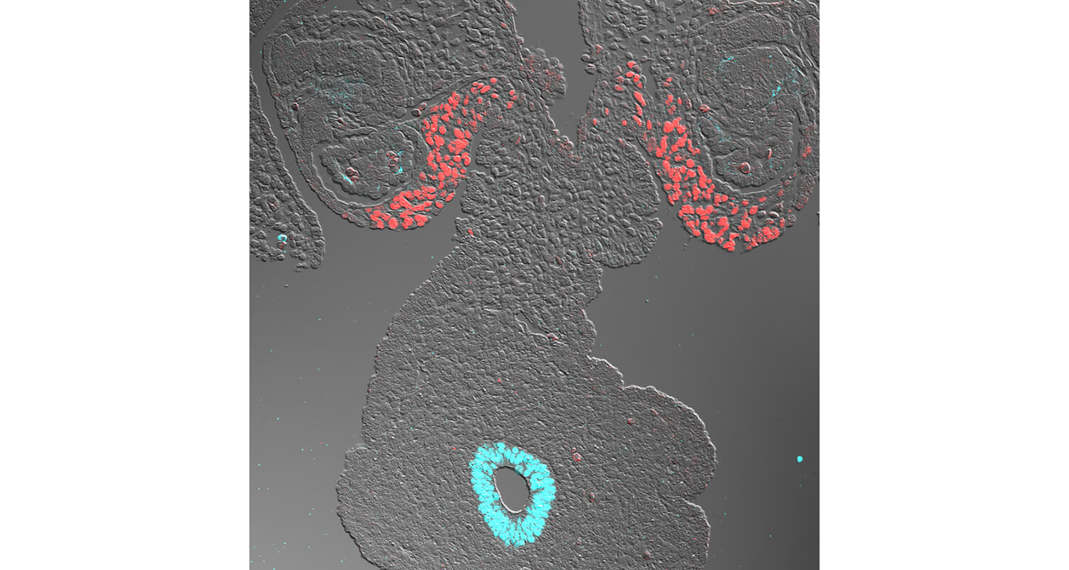 The adrenal glands, which pump out crucial hormones, develops differently in mice compared to primates, including humans, according to new research led by the School of Veterinary Medicine. At at early stage of development, the primate adrenogenic coelomic epithelium, which eventually gives rise to the adrenal glands, expresses genes (NR5A1 in red, and GATA1 in blue) in a pattern that diverged with expectations. (Image: Kotaro Sasaki)