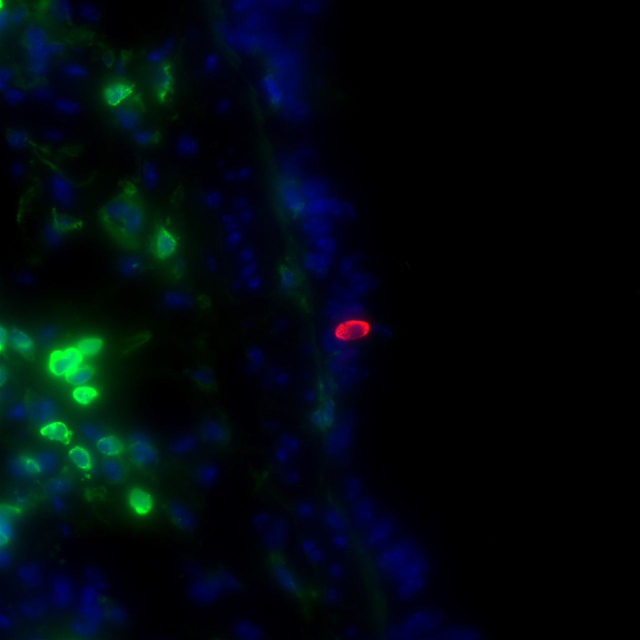 Research in mice by Montserrat Anguera and Andrew Vaughan has examined sex differences in lung cells when it comes to genes relevant to SARS-CoV-2 infection. In a sample from a mouse lung, red labels indicate infection while nearby green labels show the presence of immune cells. (Image courtesy of Andrew Vaughan)