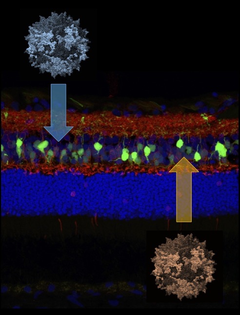 Researchers have used different strategies to ferry gene therapy to the middle layer of the retina, where ON bipolar cells are located. The therapy they developed specifically targets these cells, avoiding side effects. (Image: Courtesy of Keiko Miyadera)