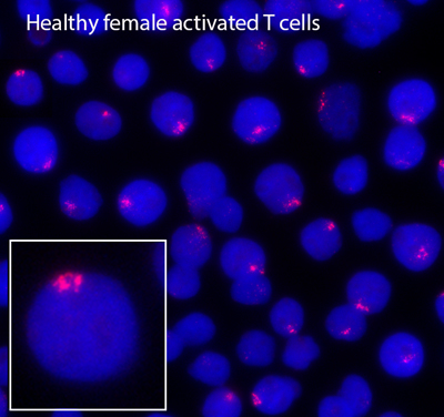 healthy female activated T cells