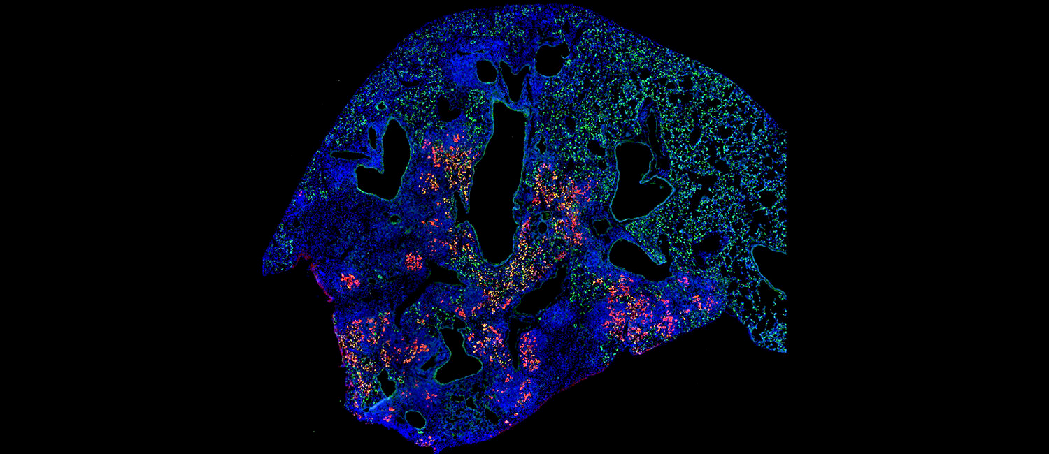 Researchers successfully transplanted a special type of lung cell called AT2 cells (labeled in green) from healthy mice into mice that had experienced a severe flu infection. The AT2 cells that engrafted (in red) appear to have helped the animals recover more robustly. (Image: Aaron Weiner/School of Veterinary Medicine)