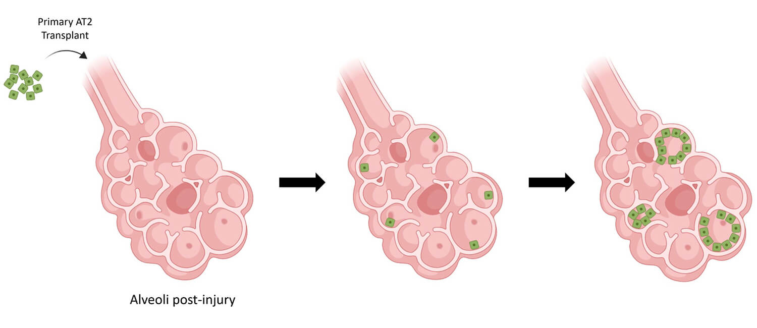 The transplanted AT2 cells were able to proliferate in the injured lung tissue, differentiating in some cases to a different type of cell that contributes to gas exchange. This stem cell-like quality of the AT2 cells allowed for improved healing. (Image: Vaughan lab/School of Veterinary Medicine)
