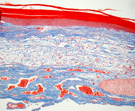 Penn Vet Comparative Pathology, Trichrome stain